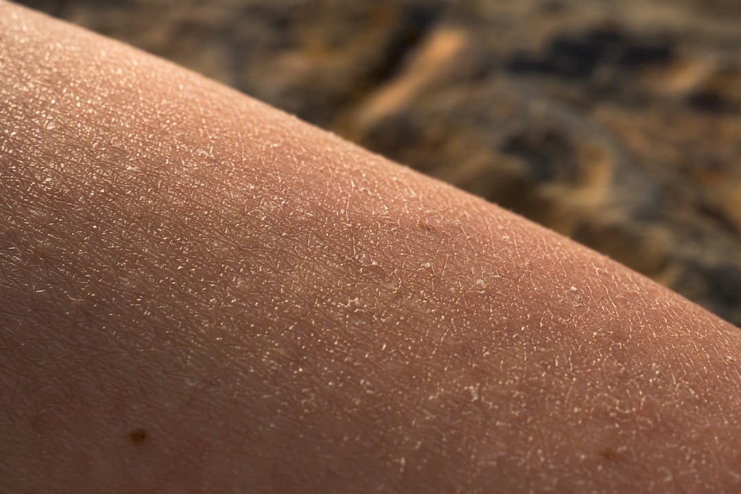 Close-up skin texture under dermatology lab light